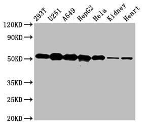 Polyclonal Rabbit anti-Human SLC25A24 / APC1 Antibody (IHC, IF, WB)