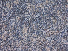 Monoclonal Mouse anti-Human ARFGAP1 Antibody (clone OTI1F6, IHC, IF, WB)