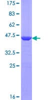 Human RMI2 / C16orf75 Protein (Recombinant GST)
