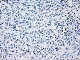 AURKC / Aurora C Antibody (clone OTI2B7)