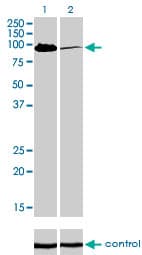 MCC Antibody (clone 1A7)