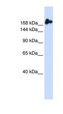 Polyclonal Rabbit anti-Human NUP98 Antibody (aa36-85, WB)