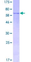 Human MAGEA9 Protein (Recombinant GST)
