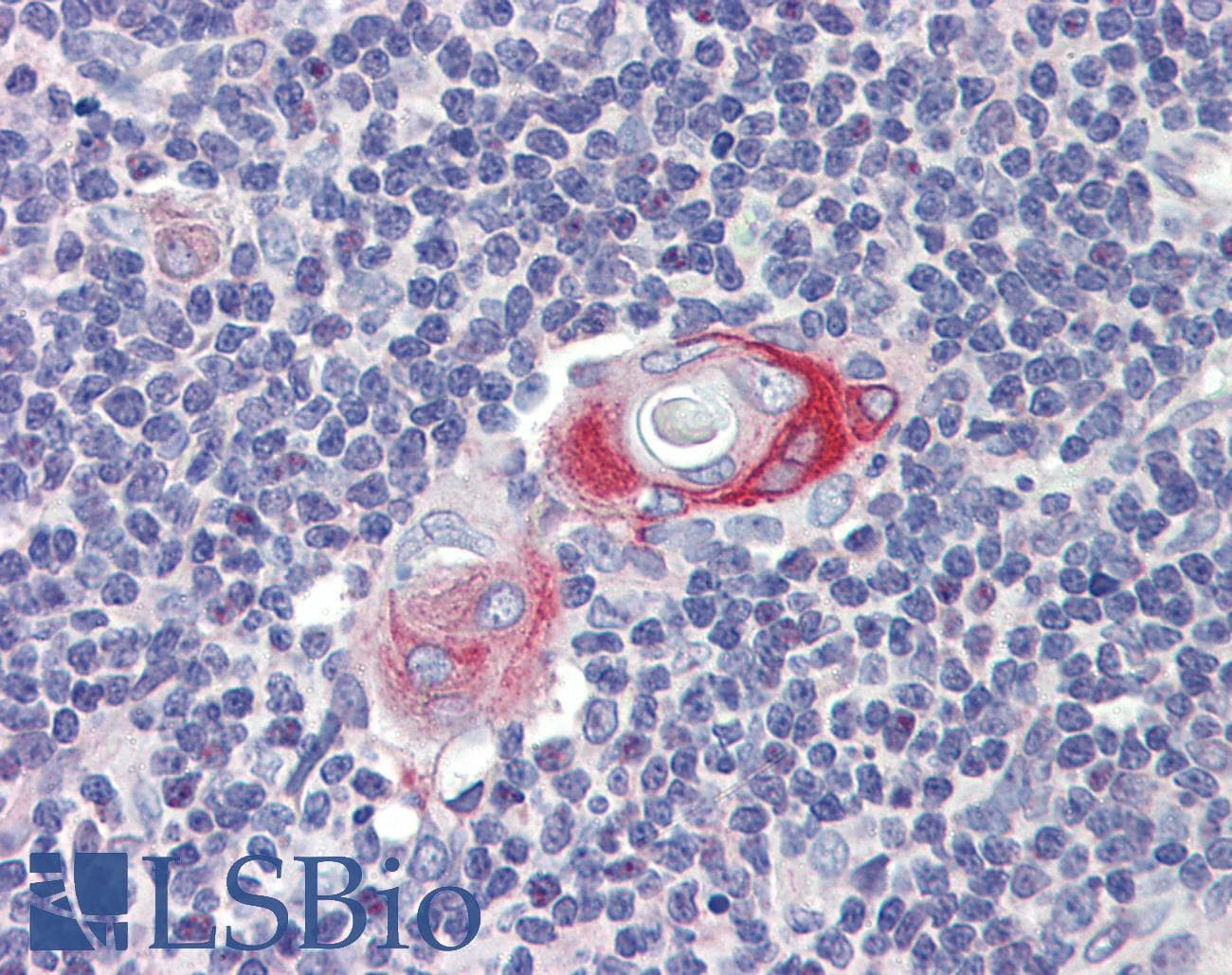Polyclonal Rabbit anti-Human CPXCR1 / CT77 Antibody (aa396-445, IHC, WB)