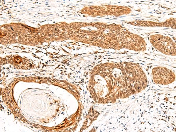 GTF3A Antibody