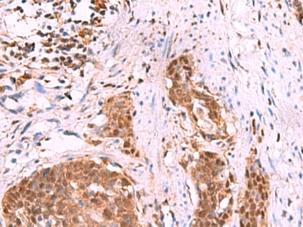 KATNAL1 Antibody