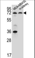 Polyclonal Rabbit anti-Human P2RX7 / P2X7 Antibody (aa563-592, IHC, WB)