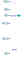 Human HAS3 Protein (Recombinant GST)