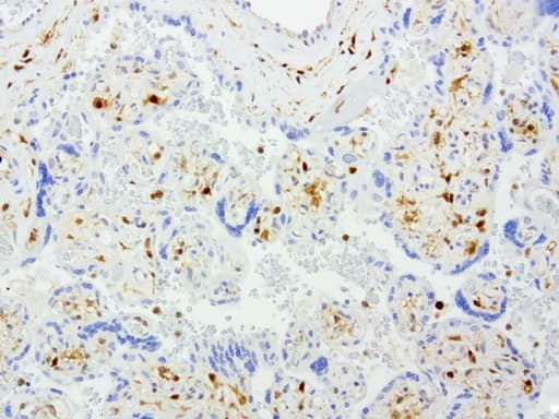 TP / Thymidine Phosphorylase Antibody (aa311-482, clone UMAB97)