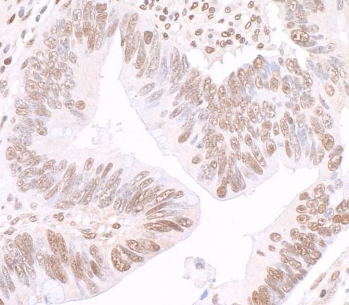 Polyclonal Rabbit anti-Human GAPDH Antibody (aa150-200, IHC, WB)