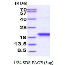 Human GLIPR2 Protein (Recombinant His)