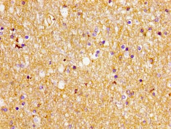 Polyclonal Rabbit anti-Human SLC1A2 / EAAT2 / GLT-1 Antibody (aa460-574, IHC, IF, WB)