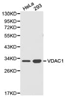 Polyclonal Rabbit anti-Human VDAC1 / PORIN Antibody (IHC, WB)