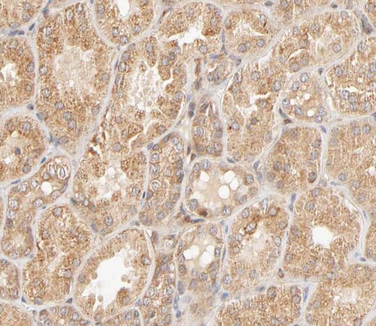Polyclonal Rabbit anti-Human STAT4 Antibody (phospho-Tyr693, IHC, IF, WB)
