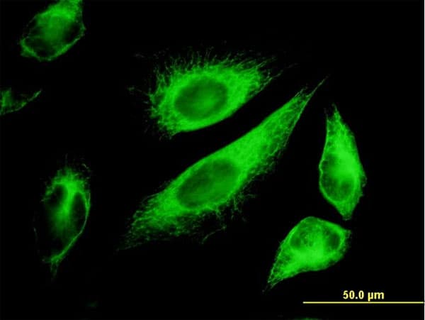 KRT18 / CK18 / Cytokeratin 18 Antibody (clone 2F8)