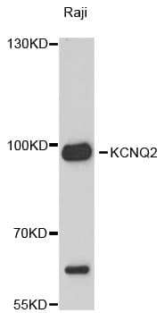 Polyclonal Rabbit anti-Human KCNQ2 Antibody (WB)