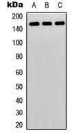 PLCG2 / PLC Gamma 2 Antibody (C-Terminus)
