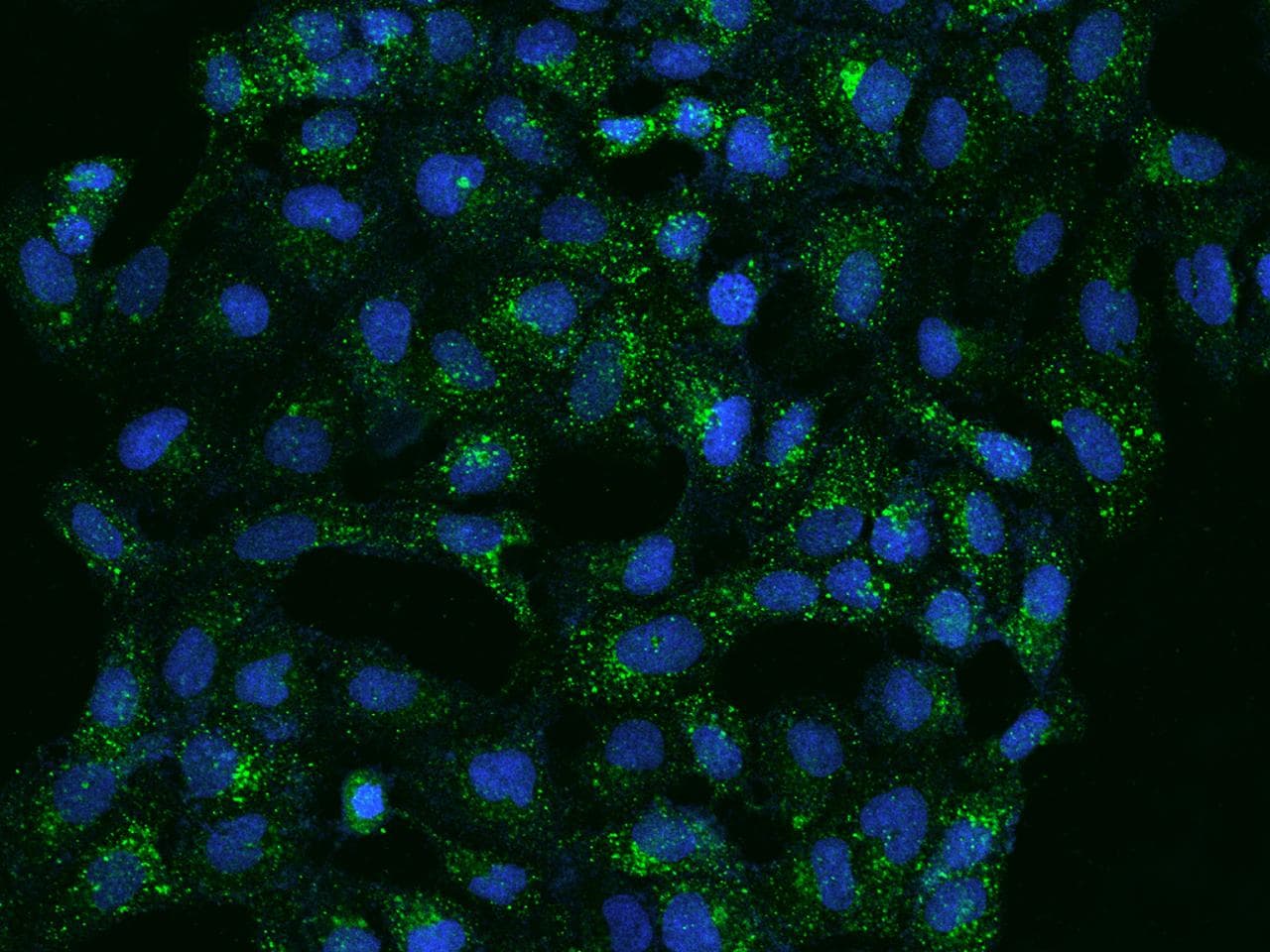 Polyclonal Rabbit anti-Human ATP6V1B2 Antibody (IHC, IF)