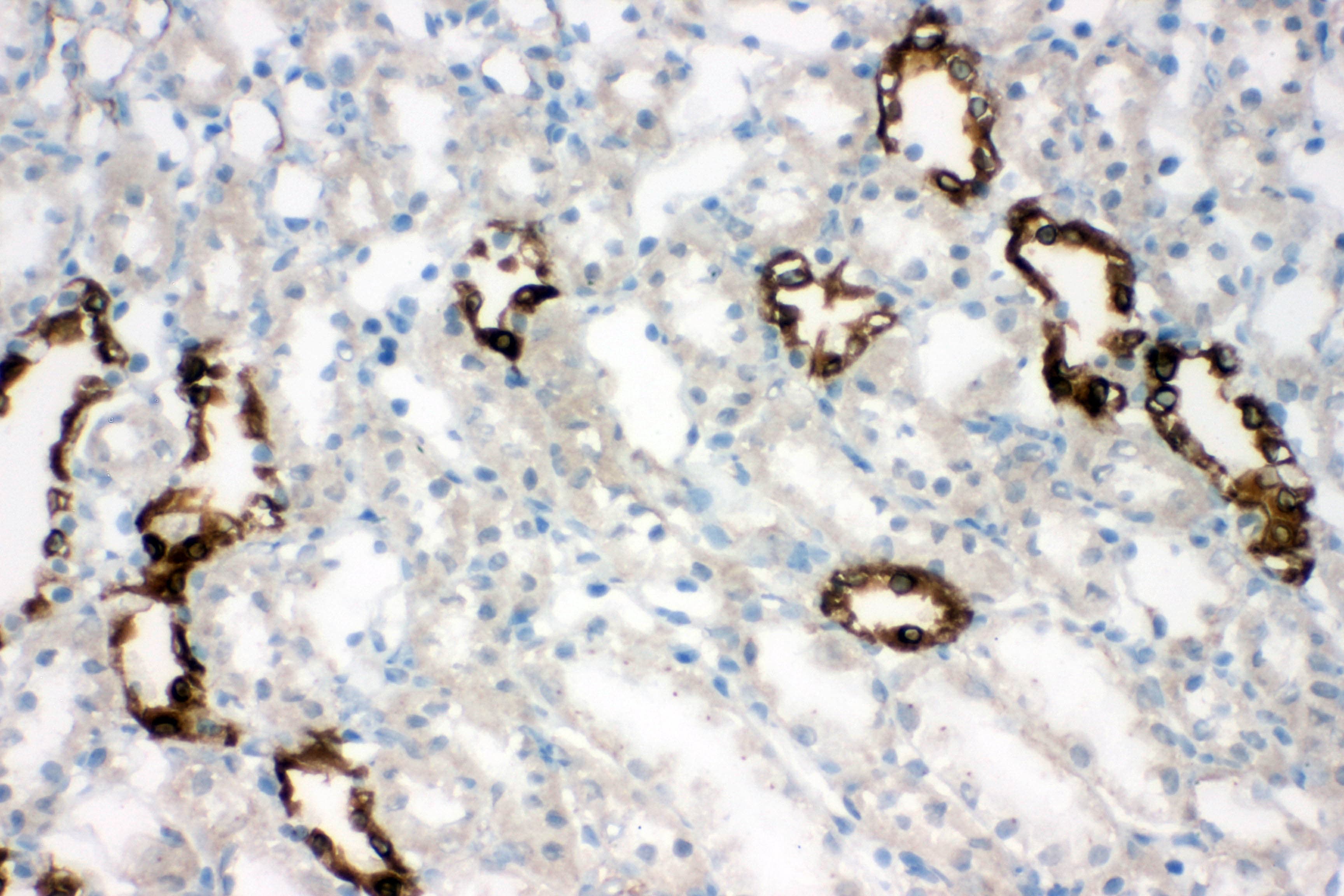 AQP2 / Aquaporin 2 Antibody (aa245-260)