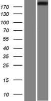 IQGAP1 Protein (Over-Expression Lysate Myc-DDK (Flag))