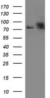 HSD17B4 Antibody (clone OTI1F3)