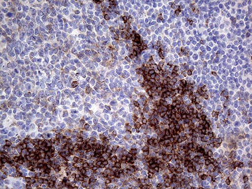 Monoclonal Mouse anti-Human CD79B / CD79 Beta Antibody (clone OTI9G1, IHC, WB)