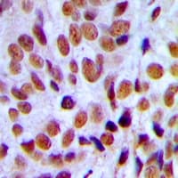 AML1 / RUNX1 Antibody (Internal)