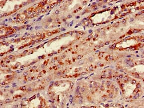 Polyclonal Rabbit anti-Human KNG1 / Kininogen / Bradykinin Antibody (Biotin, IHC, WB)
