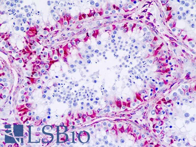 IHC-plus™ Polyclonal Rabbit anti-Human CHRM4 / M4 Antibody (aa236-285, IHC, IF)