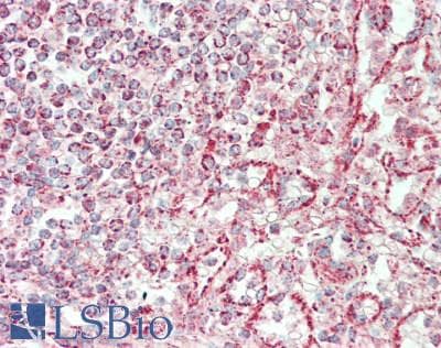 IHC-plus™ HADHA Antibody