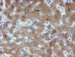 PPAT Antibody (aa42-278, clone OTI1B8)
