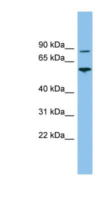 VPS52 / SACM2L Antibody (aa467-516)