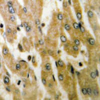 Polyclonal Rabbit anti-Human ACOT4 Antibody (C-Terminus, IHC, IF, WB)