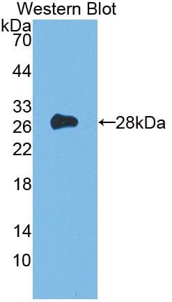 CD135 / FLT3 Antibody (aa335-544)