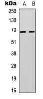 ARAF / ARAF1 / A-RAF Antibody (Internal)