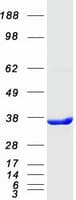 Human C21orf59 Protein (Recombinant Myc-DDK (Flag))