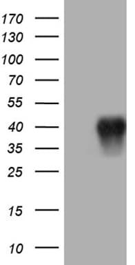 CD79B / CD79 Beta Antibody (clone OTI8A12)