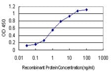 CDK5RAP3 Antibody (clone 1G4)