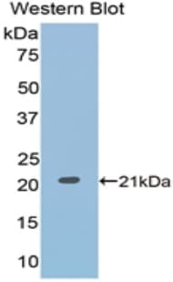 CD71 / Transferrin Receptor Antibody (aa587-756)