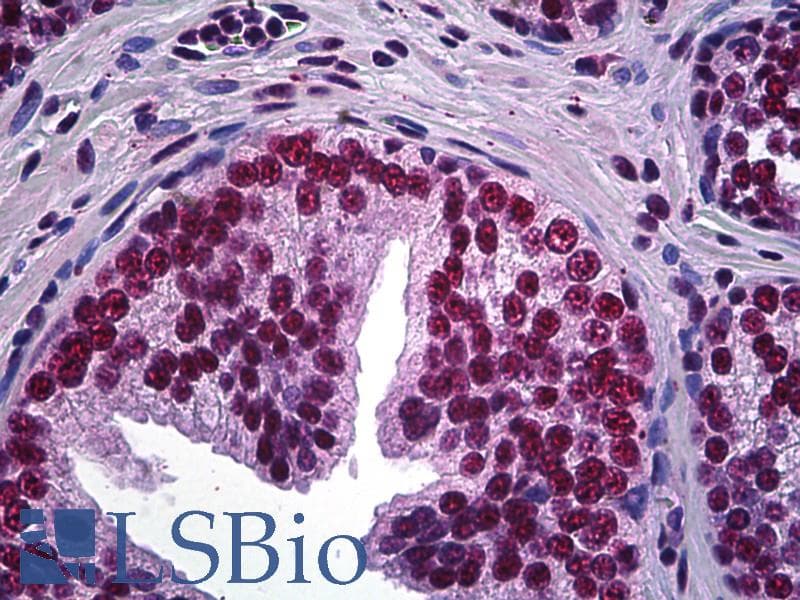 IHC-plus™ Monoclonal Mouse anti-Human LHX4 Antibody (clone 1D6, IHC, WB)