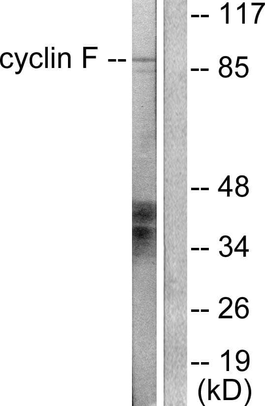 CCNF / Cyclin F Antibody