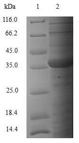 Mouse SMN1 Protein (Recombinant 10His, N-terminus + Myc, C-terminus)