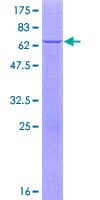 Human APOL6 / Apolipoprotein L 6 (Recombinant GST)