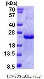 Human NHLH2 / HEN2 Protein (Recombinant His)
