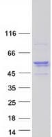 Human TCAIM Protein (Recombinant Myc-DDK (Flag))