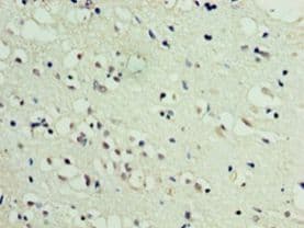 DBNDD2 Antibody (aa1-161, FITC)