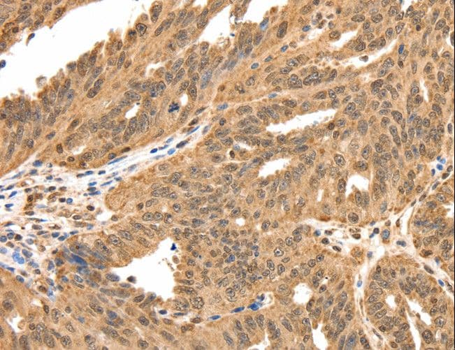 Polyclonal Rabbit anti-Human SPATA20 Antibody (IHC)