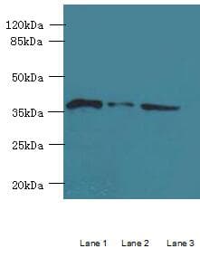 ASPHD2 Antibody