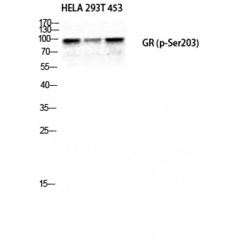 Polyclonal Rabbit anti-Human NR3C1/Glucocorticoid Receptor Antibody (140-220 aa, WB)