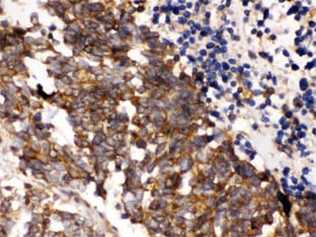 PLK1 / PLK-1 Antibody